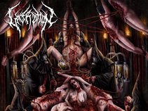 Laceration