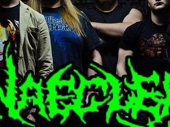 Image for Naegleria