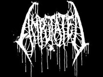 Amputated