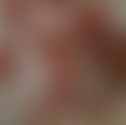 Pulling teeth cover art