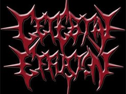 Image for Cerebral Effusion