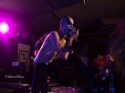 Image for Avascular Necrosis