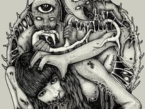 ANUS DISEASE