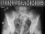 Image for CUNTHAMMER