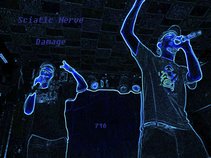 Sciatic Nerve Damage