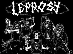 Image for Leprosy