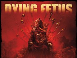 Dying Fetus