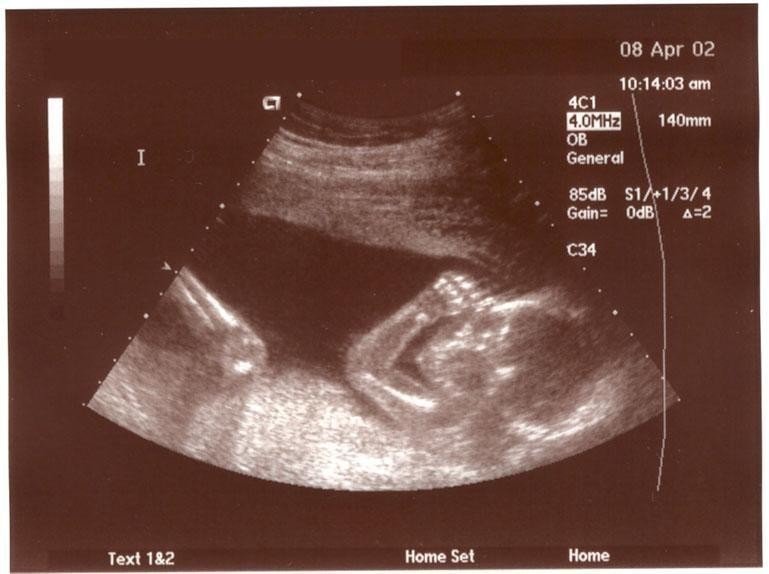 ReverbNation profile picture for @ultrasound