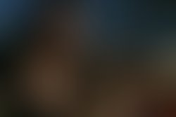 1322769162 baby teeth