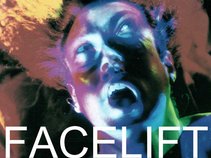 Facelift