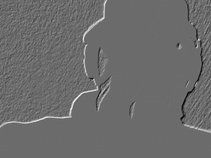 Airway