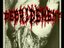 Debridement