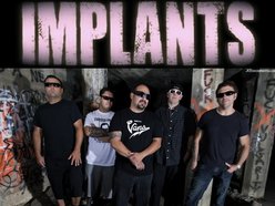 Image for IMPLANTS