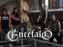 Encefalo