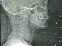 The East Village Vampire