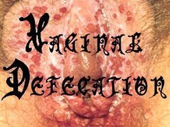 Image for vaginal defecation