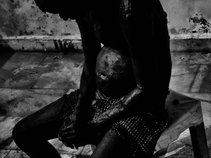 Severe Depressive Disorder