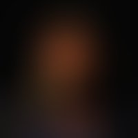 1452636592 mick 200x200 300px