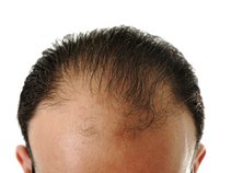 The Sound Of Hair