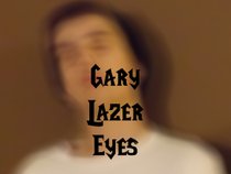 Gary Lazer Eyes