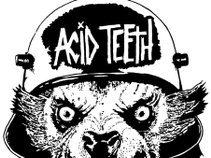 Acid Teeth