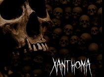 Xanthoma