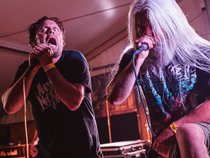 BRAINCASKET