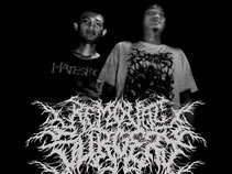 Removal Surgery_SBDM