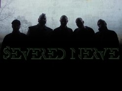 Image for Severed Nerve