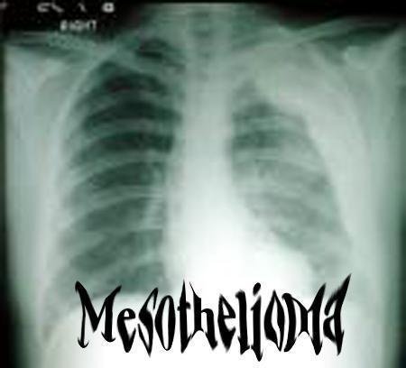 ReverbNation profile picture for @mesothelioma