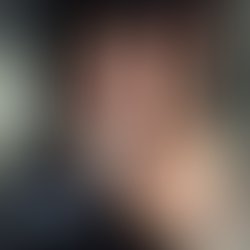 Abcm coping mechanism 72