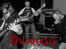 Mydriasis