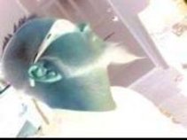skieswillbleed