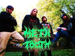 Image for Meth Tooth