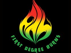 Image for First Degree Burns