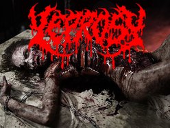 Image for LEPROSY