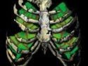 Skeleton Crew Gene