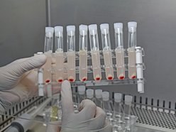 Células madre tratamiento