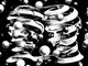 Escher