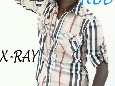 Ahmad X_ray photo