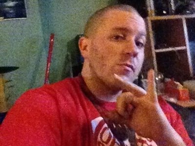 Scurvey Sickness photo