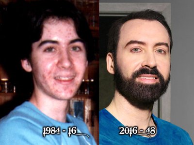 Breck Stewart #BeforeAndAfter 1984-2016