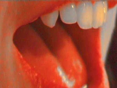 The Slit Plasters photo