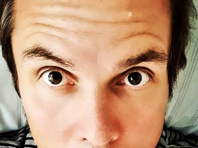 Operation gut überstanden!✌😘🎶#NichtsGetan