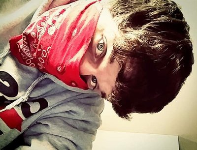 $##Dopamine##$
