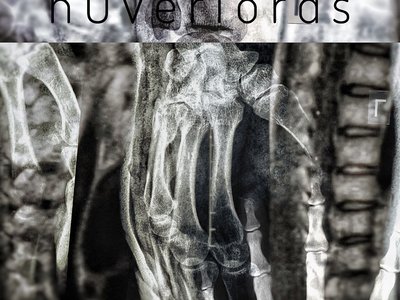 nOverlords