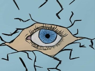 Surveillance
