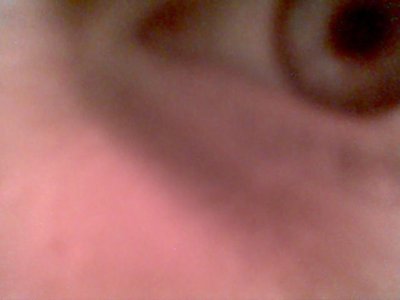 Eye-Phone
