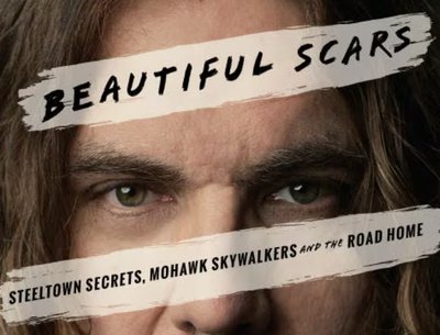 Tom Wilson Beautiful Scars