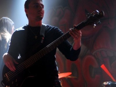 Kerion photo